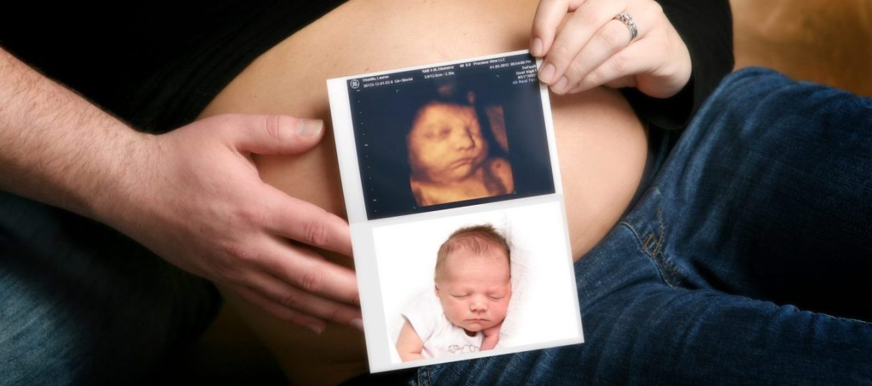 diferencia entre ecografia 4d y 5d