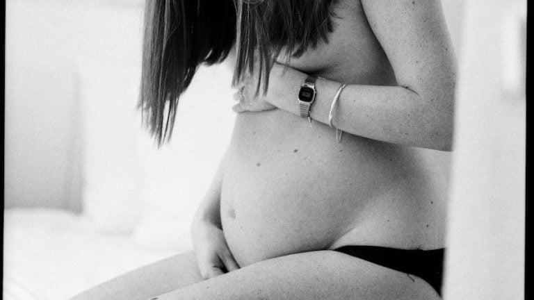 varices vulvares en el embarazo