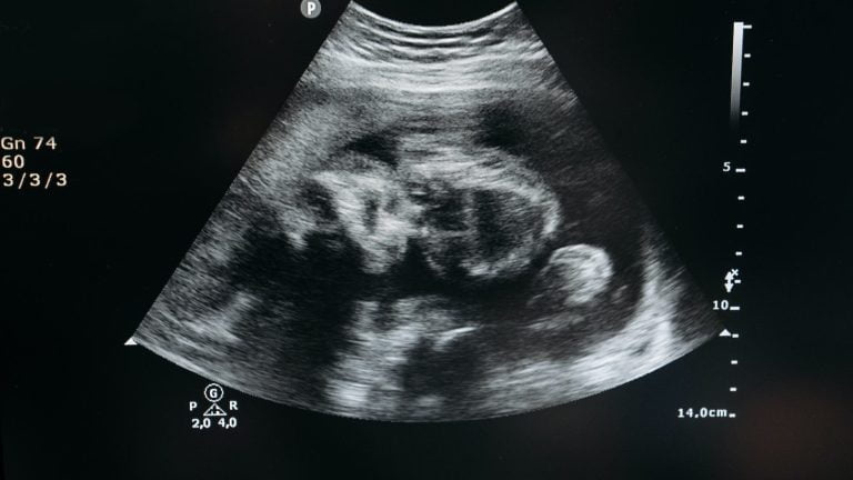 desarrollo fetal