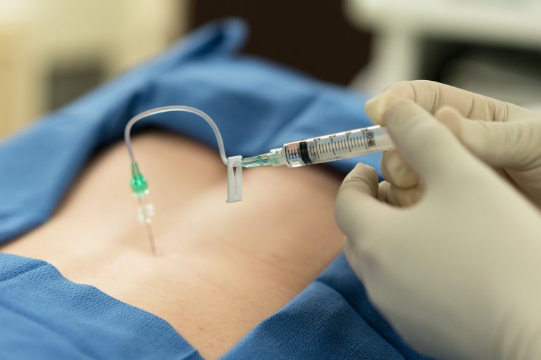 Efectos secundarios de la epidural: ¿Qué debes saber?
